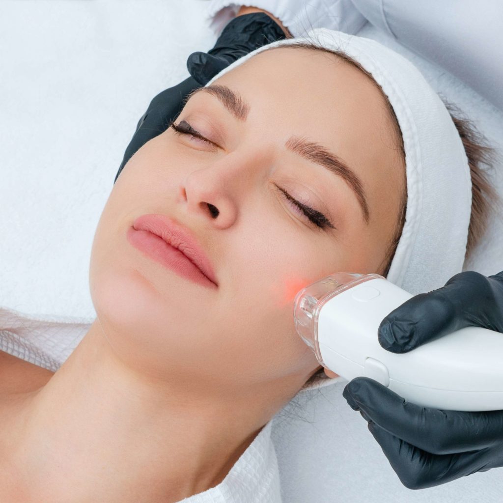 Portfolio 13 Acne Laser Treatment | Yuma, Az | Amara Rejuve