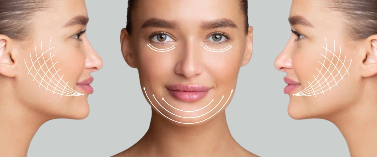 What you need to know about Euro Thread Lift