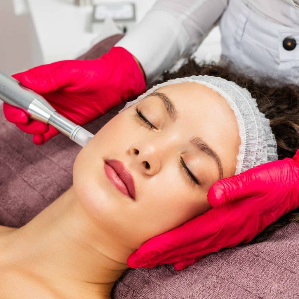 Portfolio 8 Microneedling | Yuma, Az | Amara Rejuve
