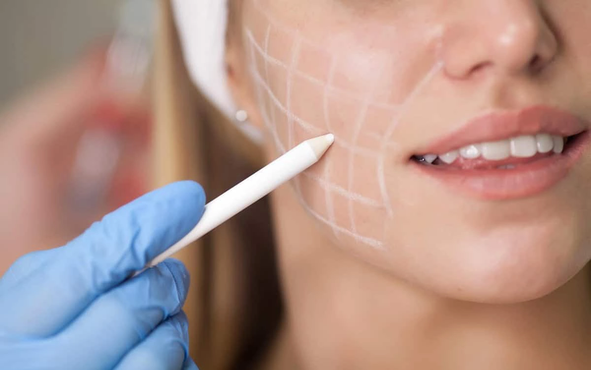 What type of facial treatment do I need for acne removal