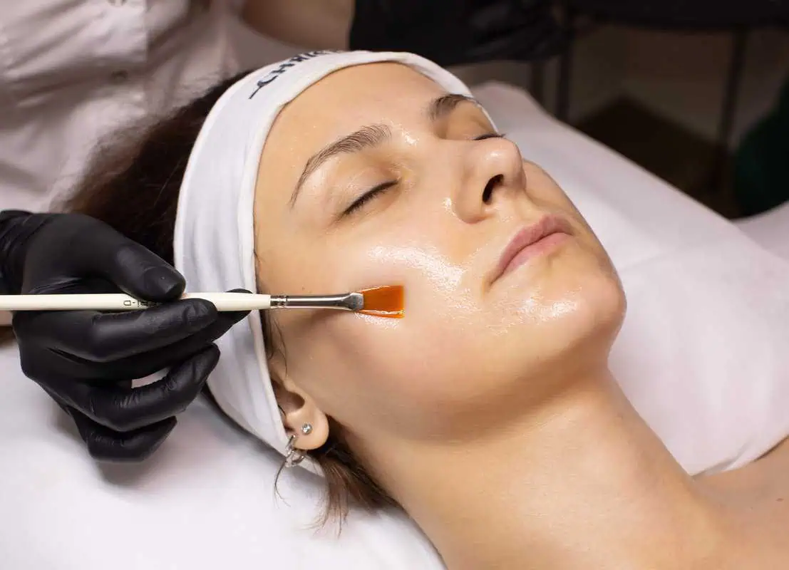 chemial peels by Amara Rejuve Medical Spa in Yuma, Arizona