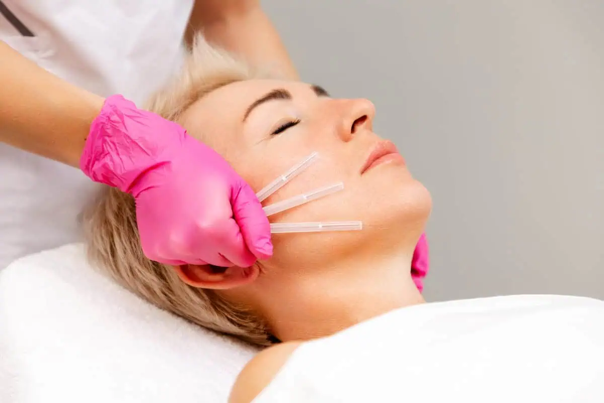 PDO Threads for Skin Tightening by Amara Rejuve Medical Spa in Yuma, AZ