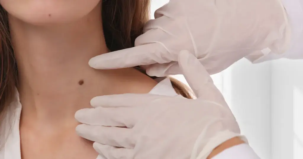 Lamprobe Lamprobe for Skin Imperfections : Safe and Effective