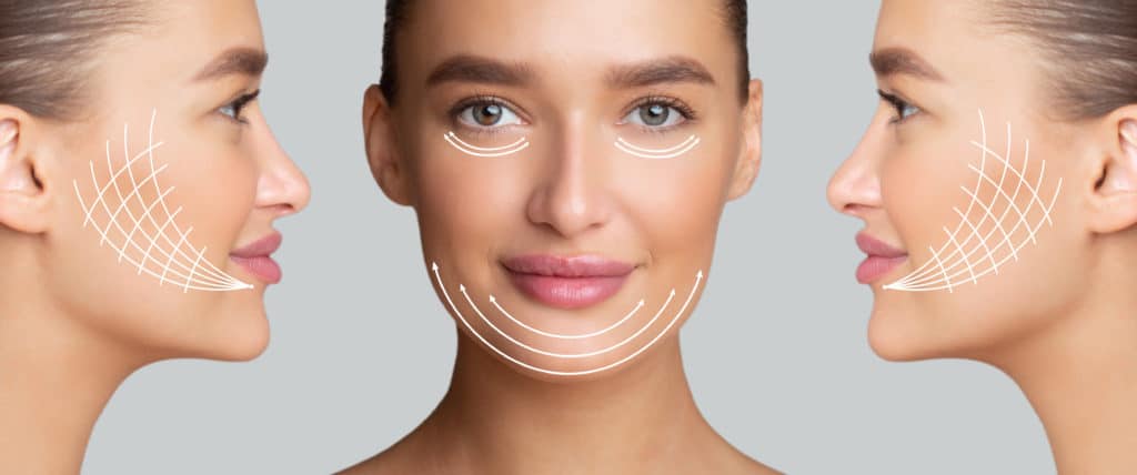 What you need to know about Euro Thread Lift 4 What you need to know about Euro Thread Lift