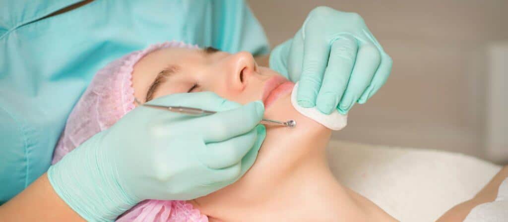Can Chin Fat Be Removed? 1 Can Chin Fat Be Removed