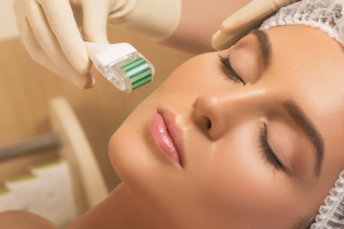 What Is Microneedling Is It Beneficial for Your Skin
