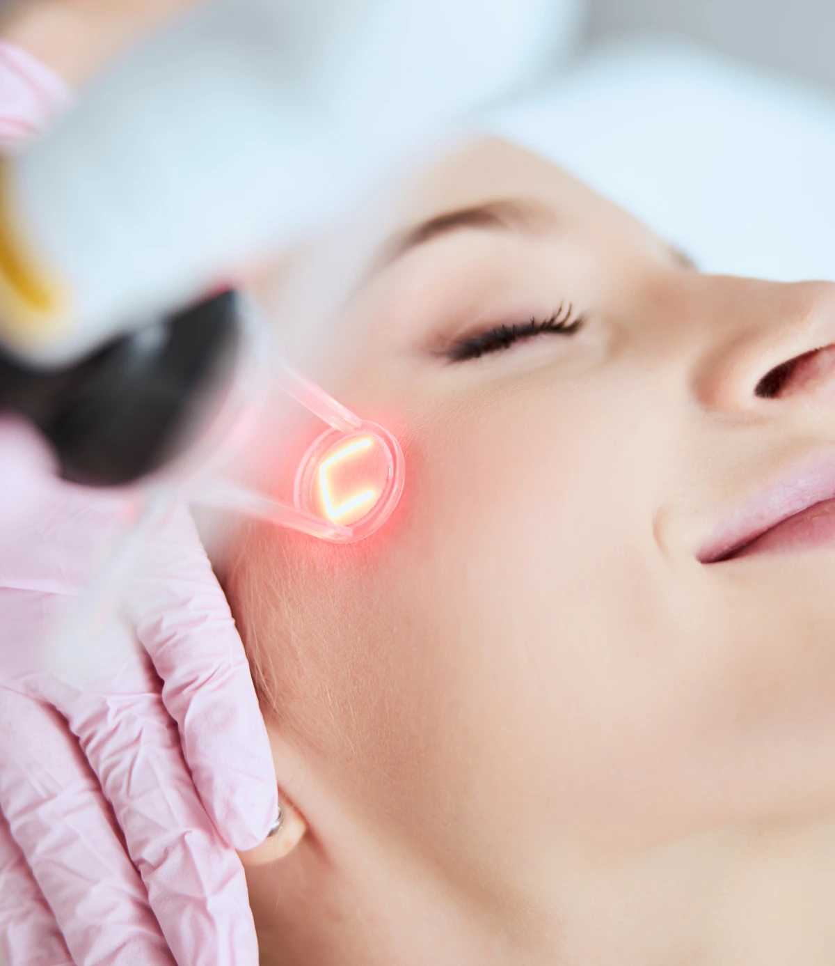 CO2 laser resurfacing treatment in Yuma AZ at Amara Rejuve Medical Spa and Laser