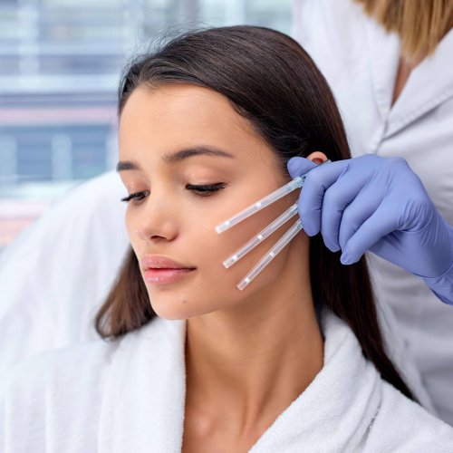 Best PDO Threadlift Treatment in Yuma, AZ Amara Rejuve Medical Spa